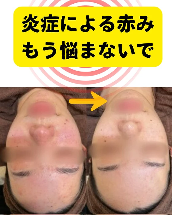 画像300