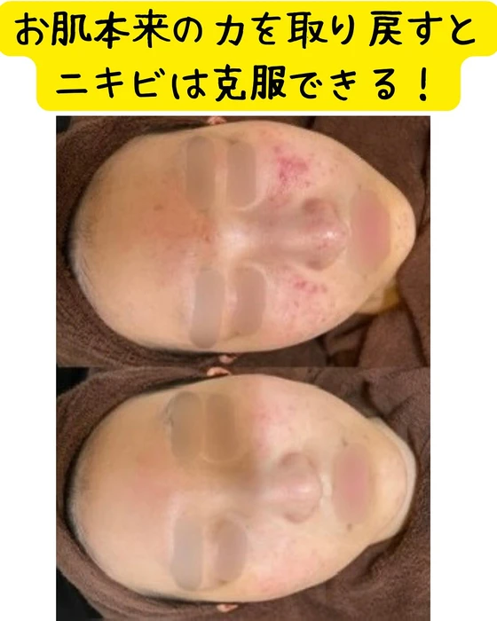 画像315