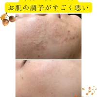 画像321