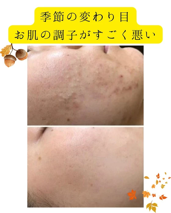 画像321