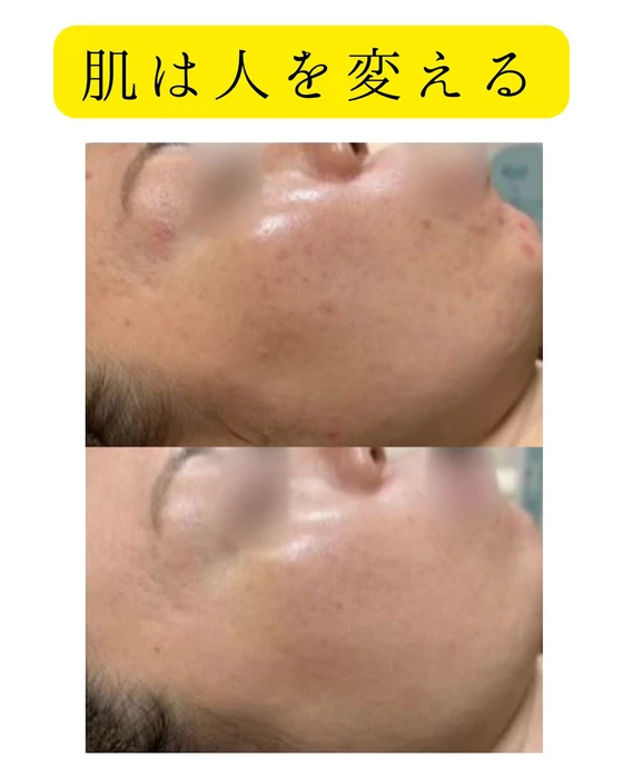 画像327