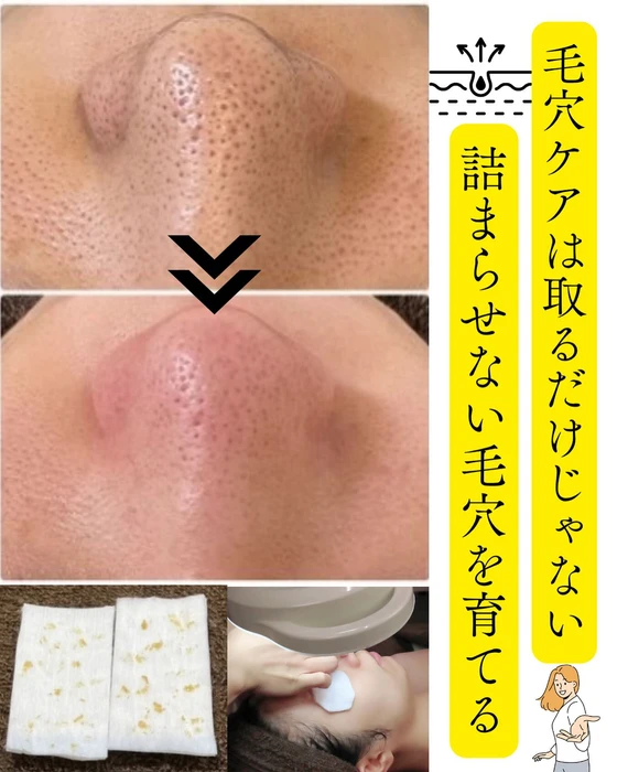 画像334