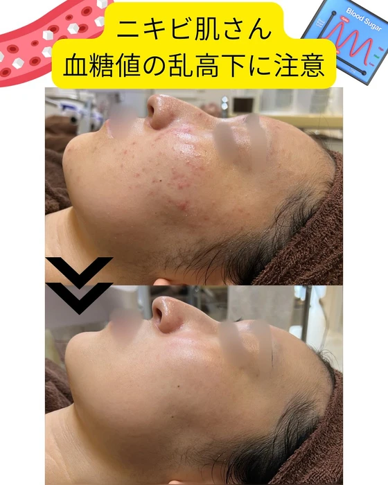 画像341