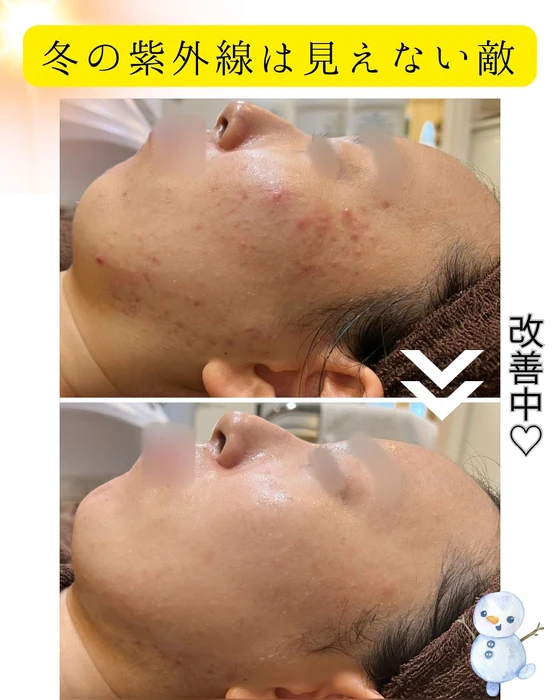画像355