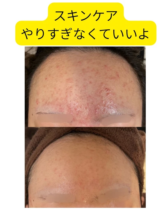 画像372