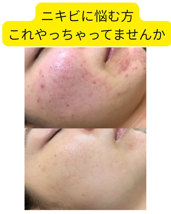 画像378