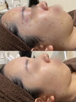 4. ビフォーアフター事例